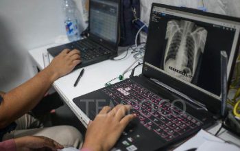 Dinkes Bandar Lampung Gunakan X-Ray Portabel Percepat Deteksi TBC