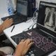 Dinkes Bandar Lampung Gunakan X-Ray Portabel Percepat Deteksi TBC